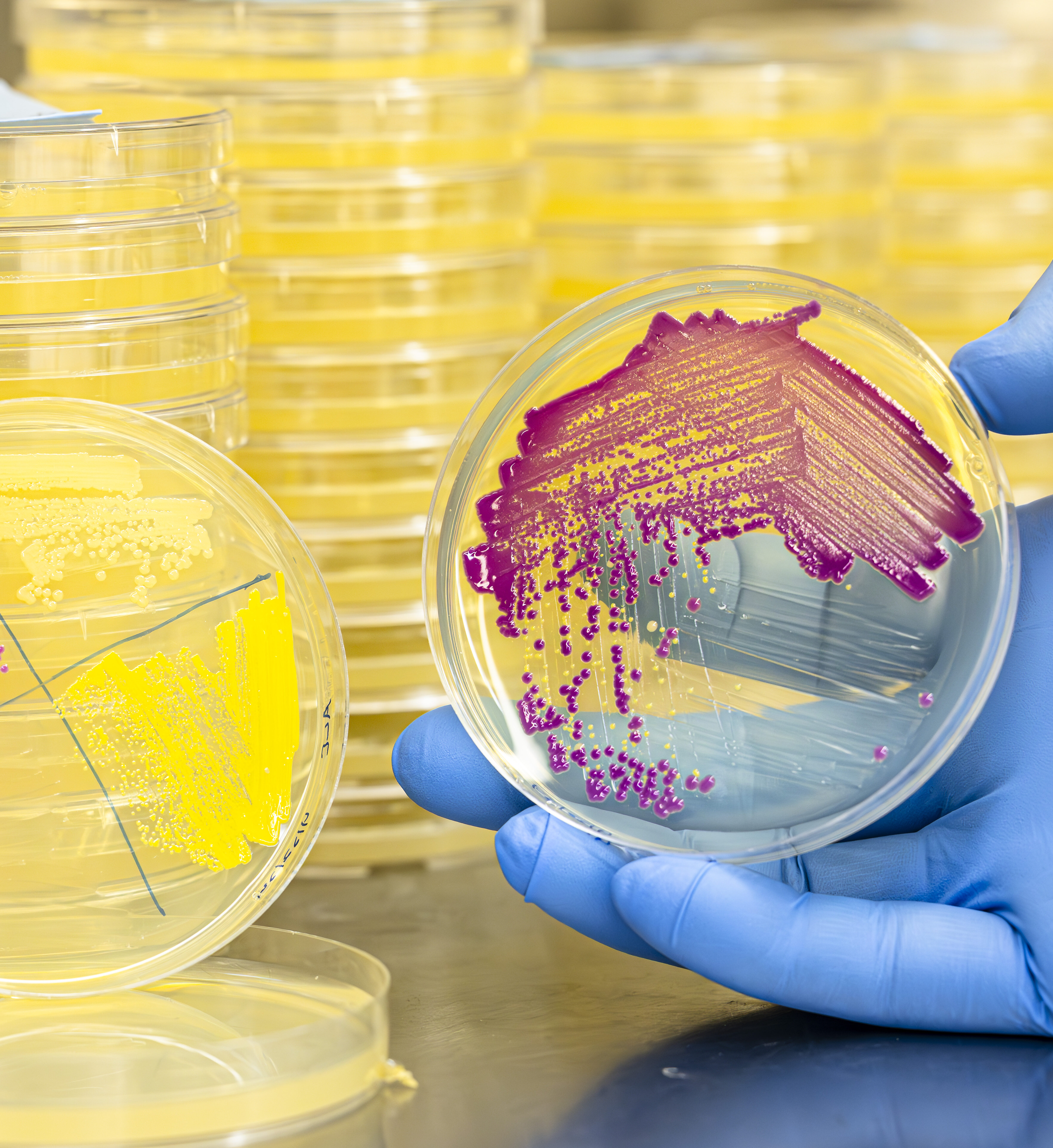 A hand wearing a blue latex glove holds a plate of vibrant magenta microbes towards the camera, stacks of vibrant yellow microbe plates are visible in the background