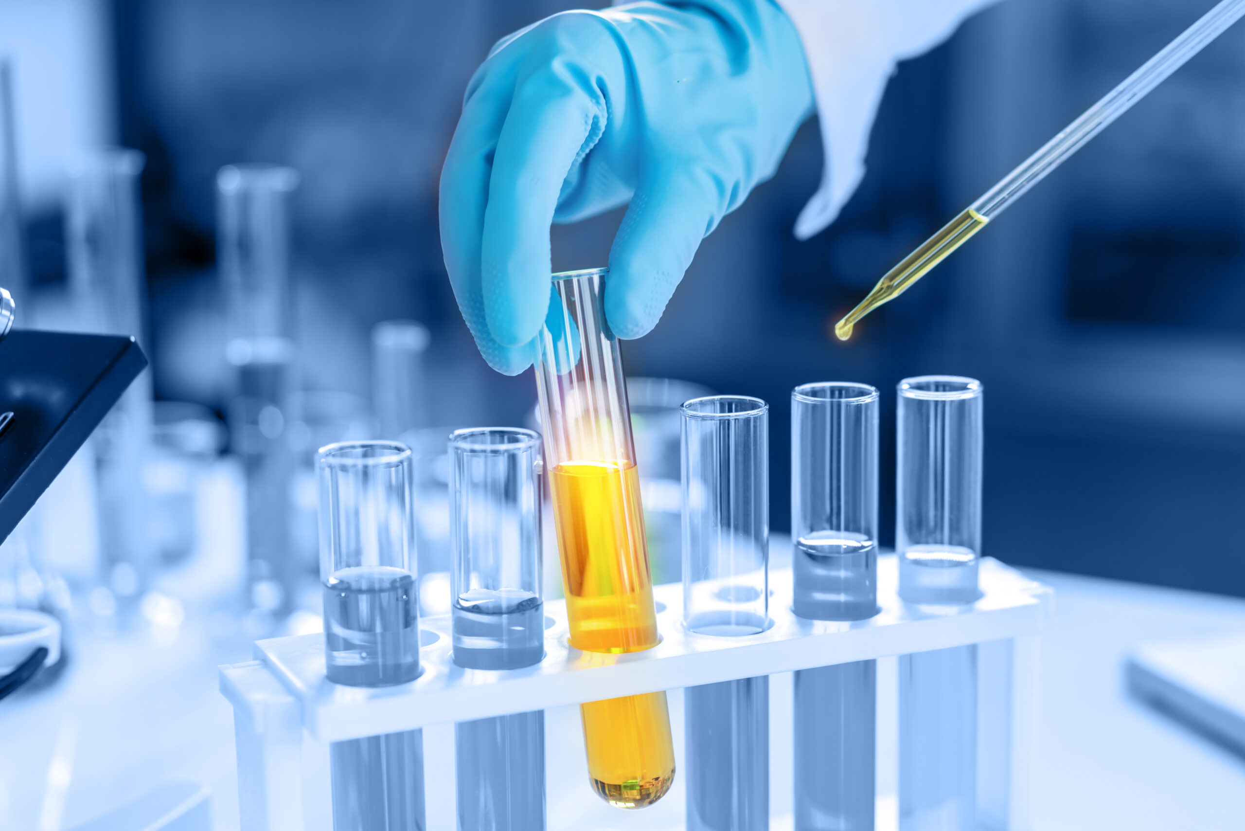 Hand holding beaker filled with yellow liquid against a blue background. Image from CasanoWa Stutio, stock.adobe.com